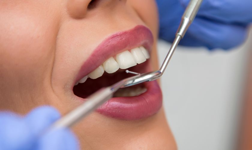 5 Essential Tips for Dental Care